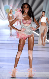 Modelle victoria secret Winnie Harlow